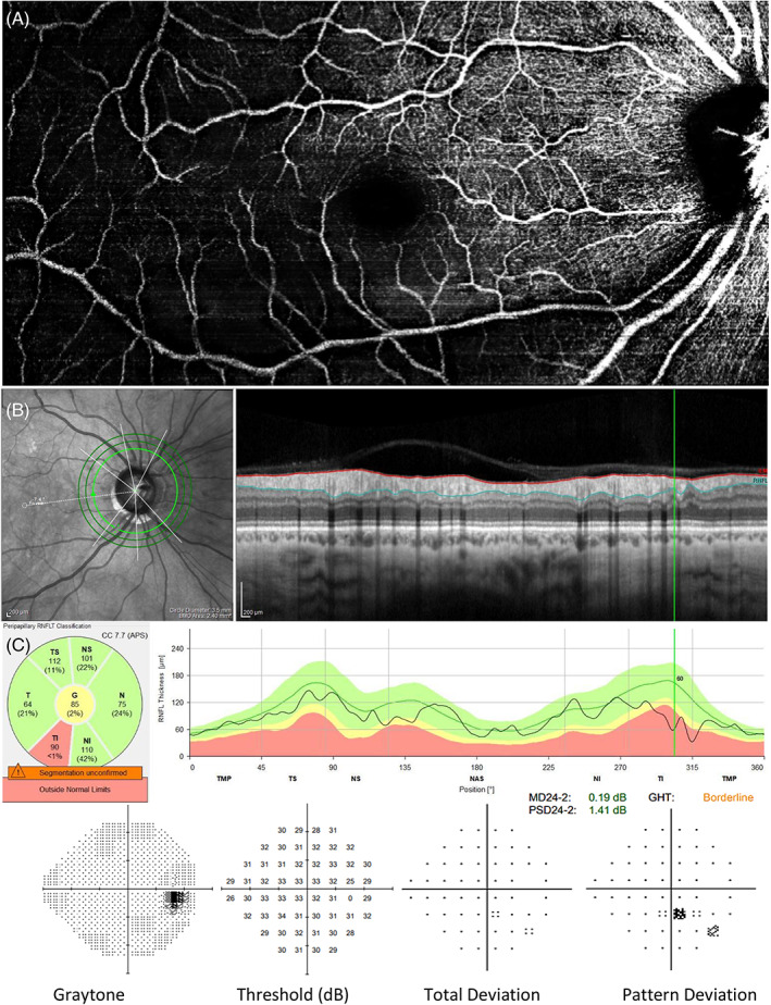 FIGURE 3