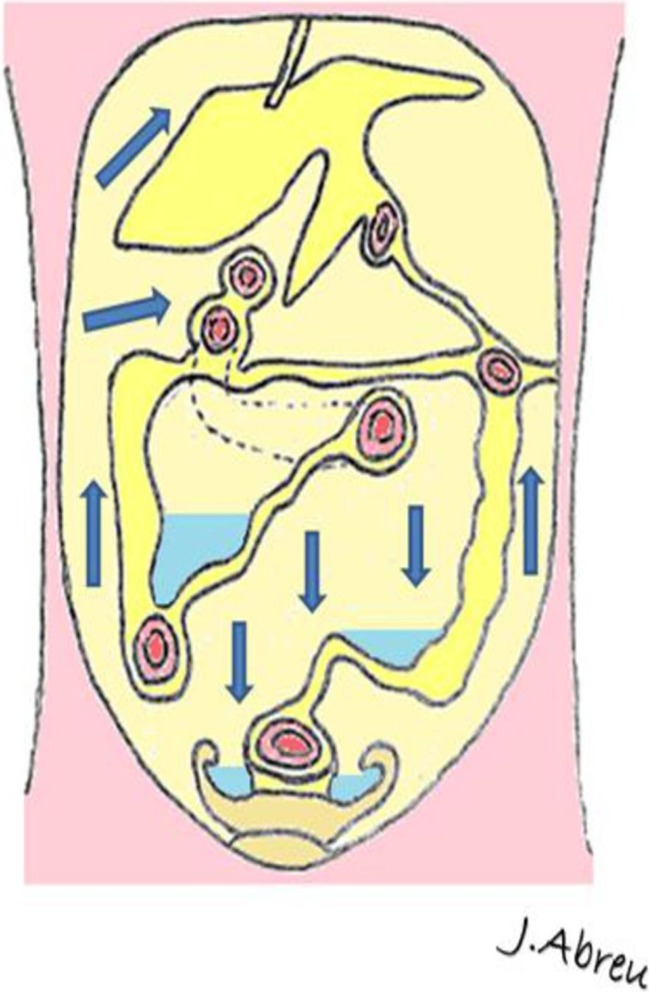 Fig. 1