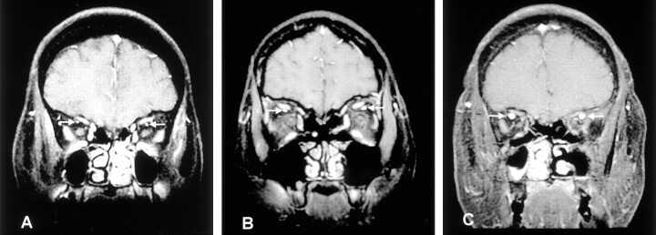 Fig 1.