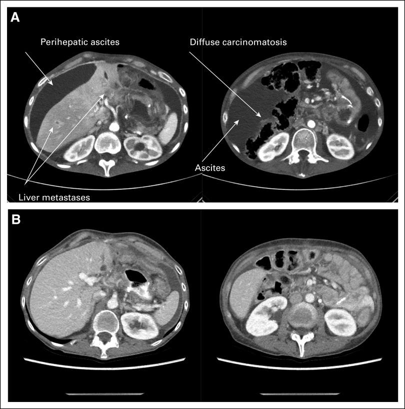 FIG 3.