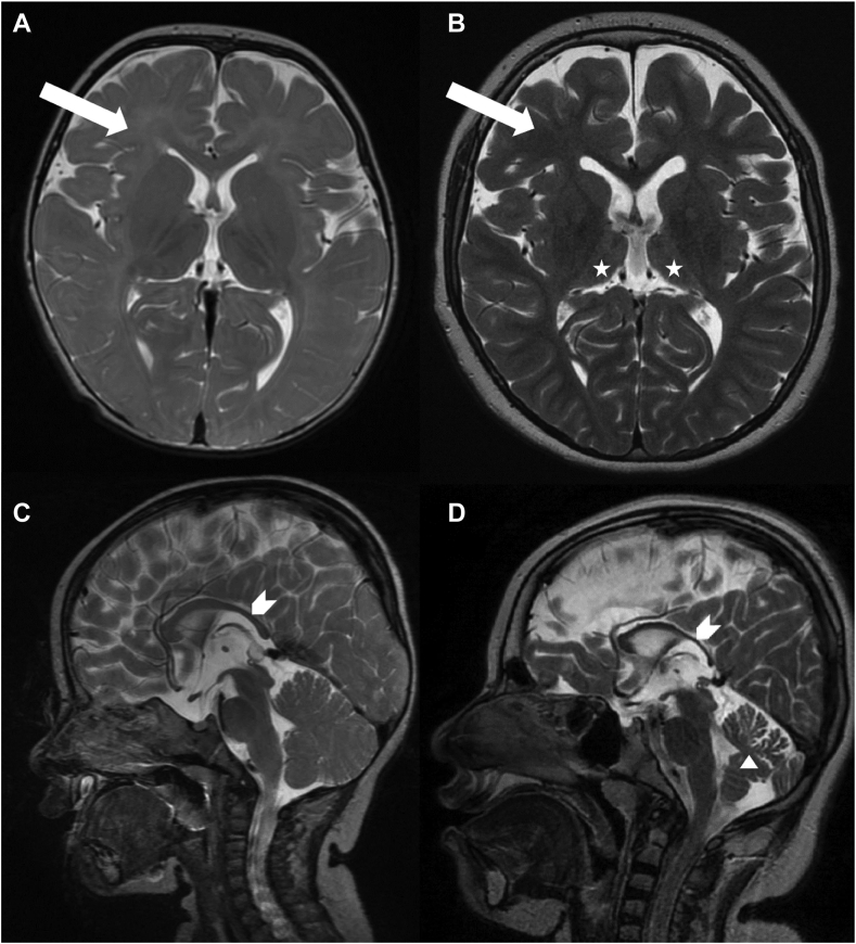 Fig. 3