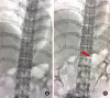 Fig. 3
