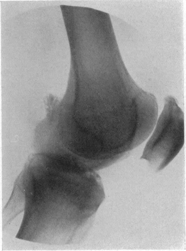 FIG. 8.