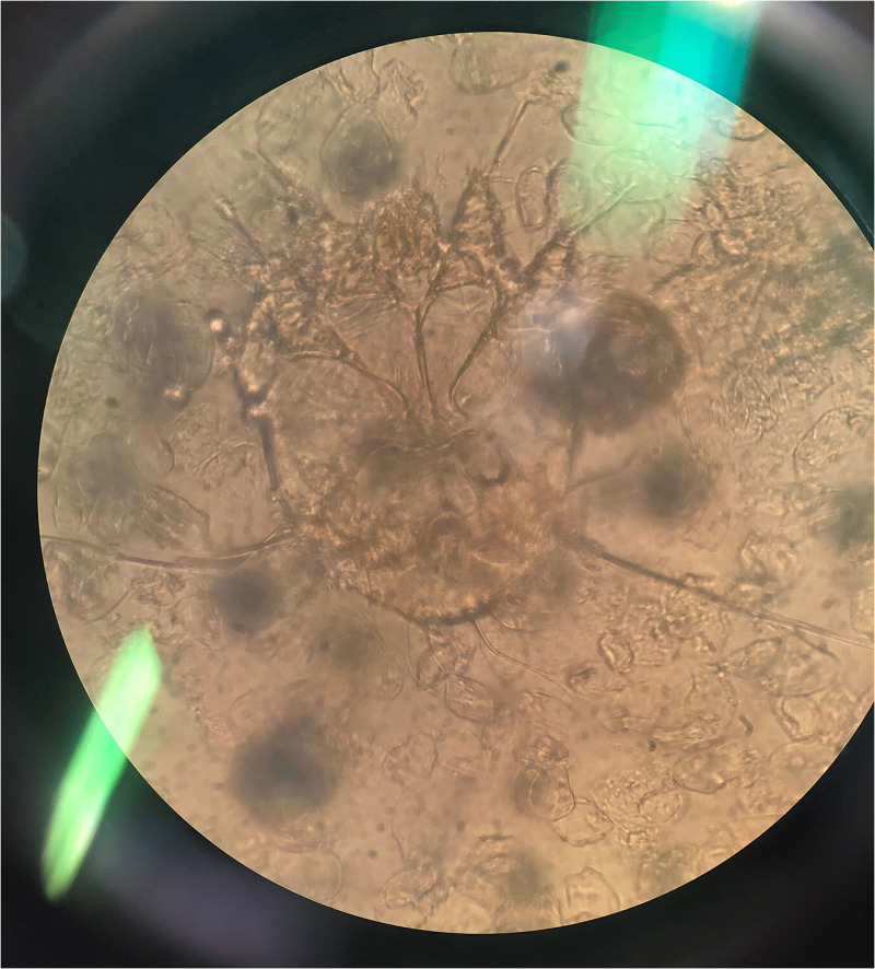 Figure 2.