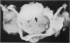 215