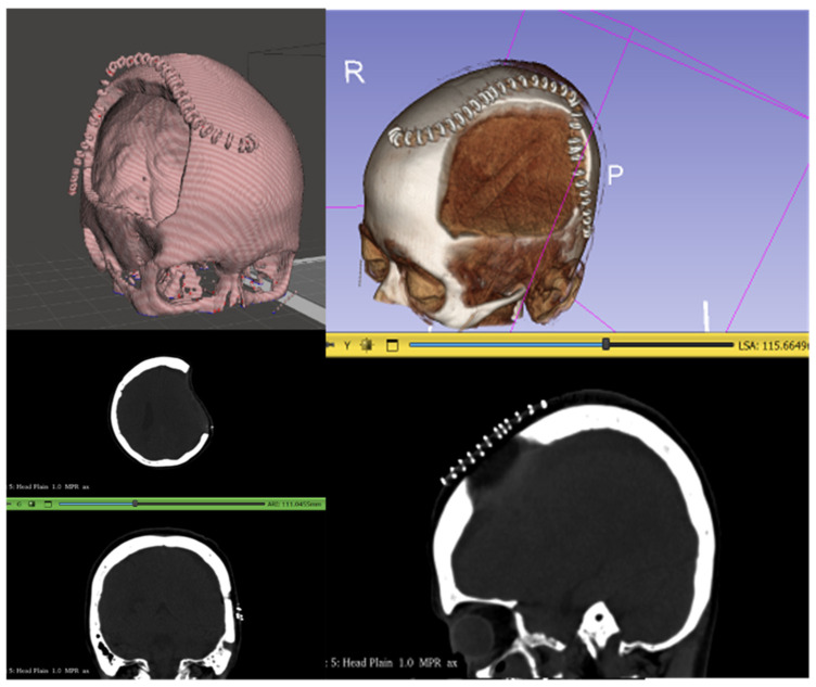 Figure 2