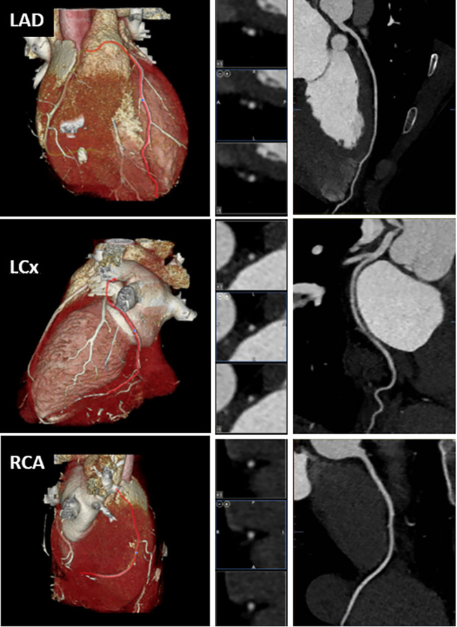 Figure 2