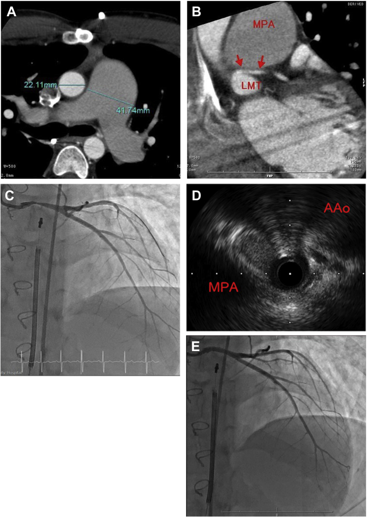 Figure 1