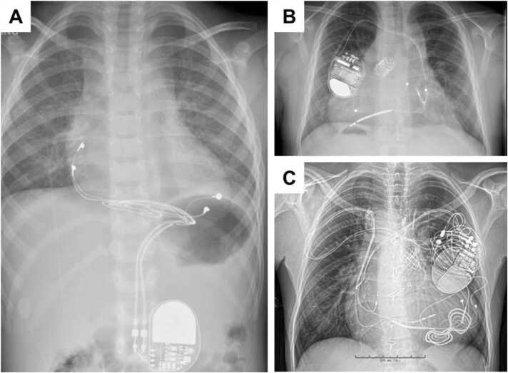 Fig. 4