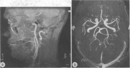 FIG 10