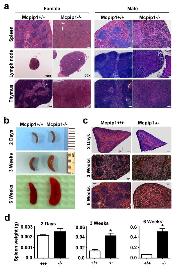 Targeted Disruption of MCPIP1/Zc3h12a Results in Fatal Inflammatory ...