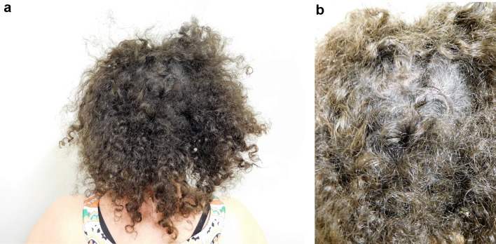 Fig. 3