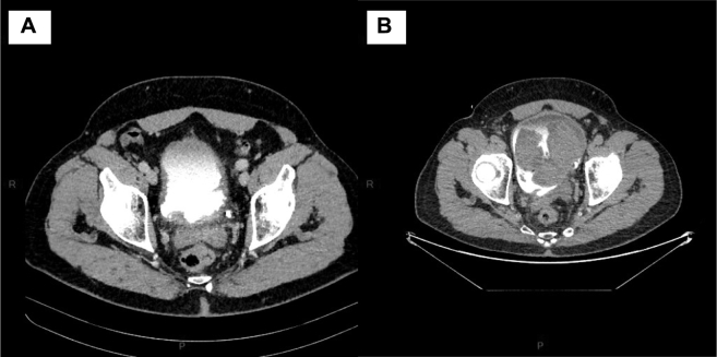 Figure 3