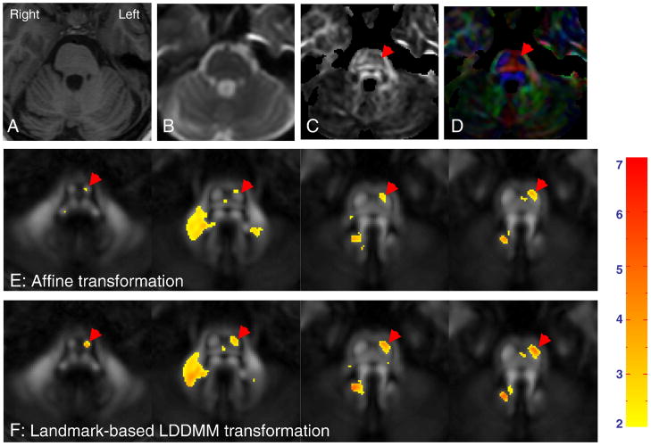 Fig. 4