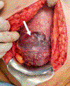Fig 3: