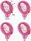 Fig 1: