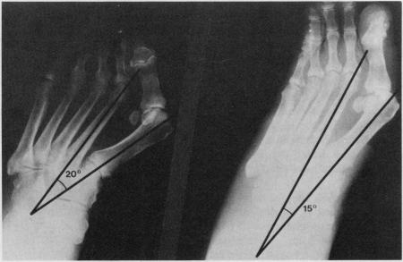 FIG. 9