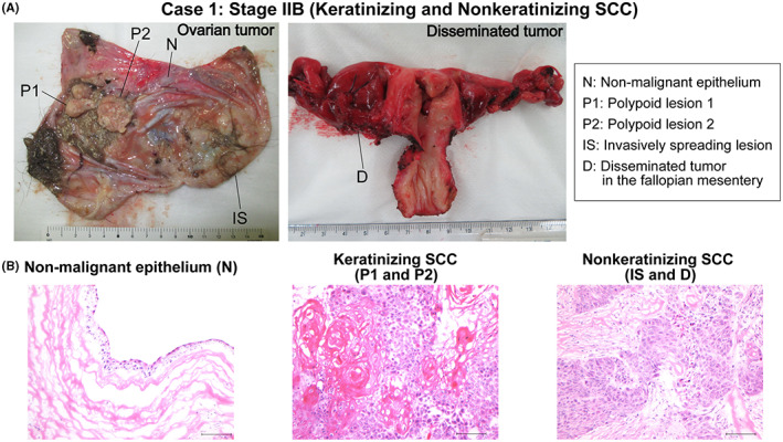 FIGURE 1