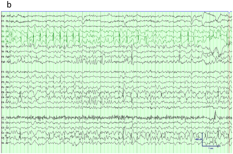 Fig 7.