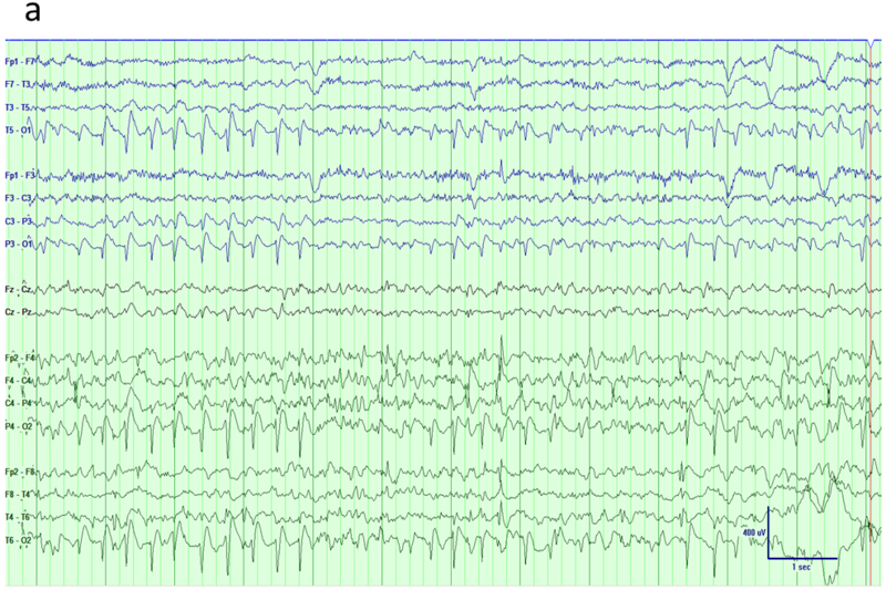 Fig 7.