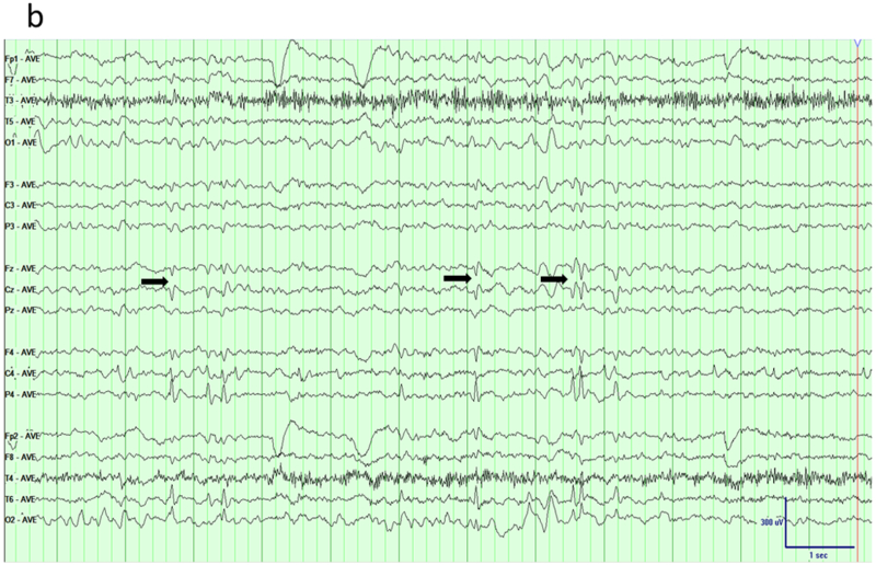 Fig 6.