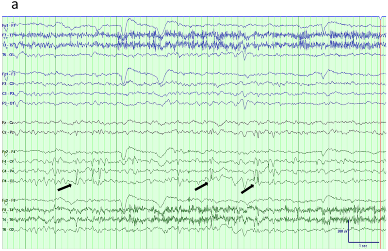 Fig 6.