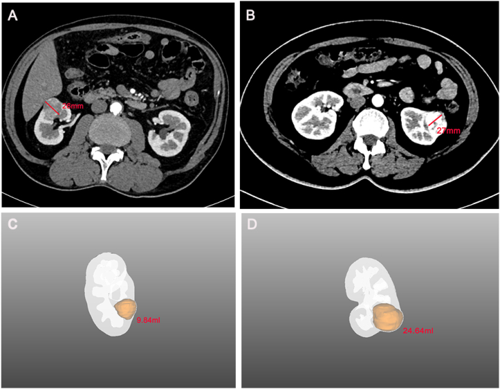 Fig. 11