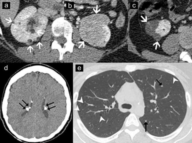 Figure 11.