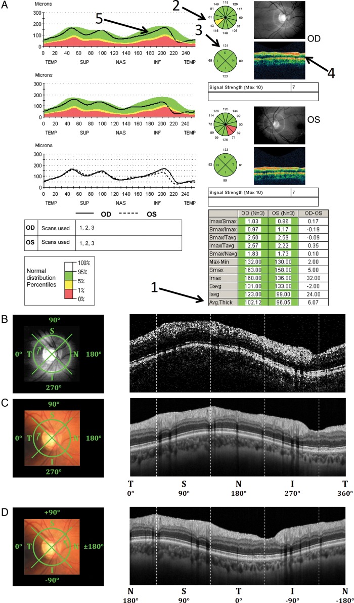 Figure 1