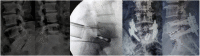 Fig 10