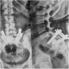 Fig 14