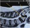 Fig 11