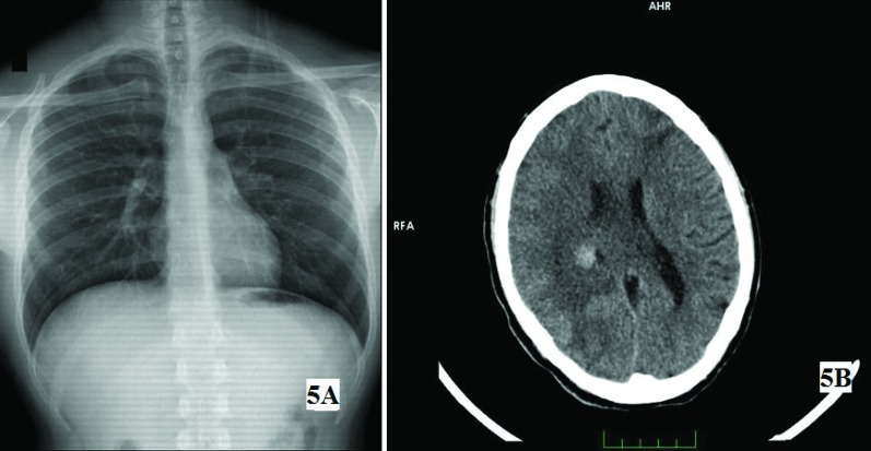 Fig. 5