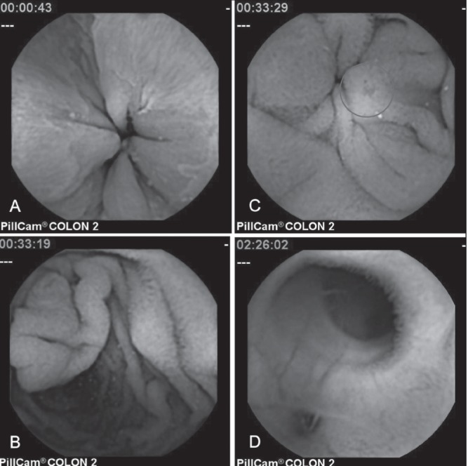 Figure 2)