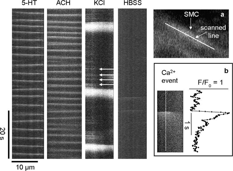 Figure 13. 