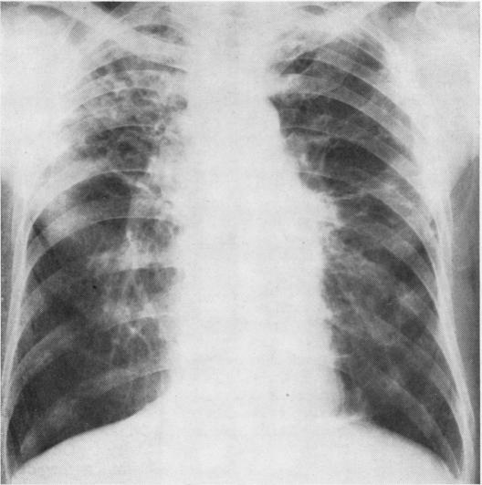 graphic file with name thorax00101-0007-a.jpg