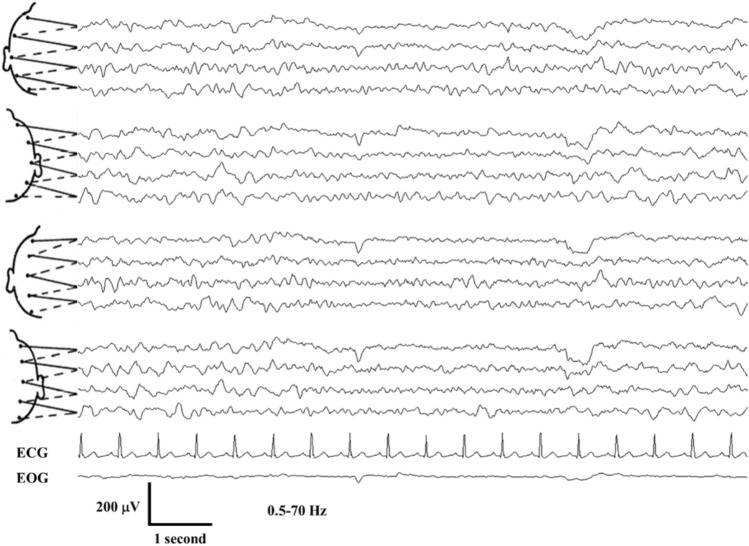 Fig. 1