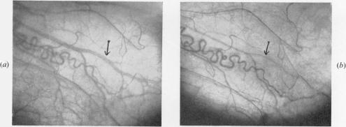 Figs 3(a) and 3(b)