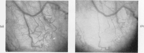 Figs 2(a) and 2(b)