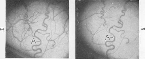 Figs 1(a) and 1(b)