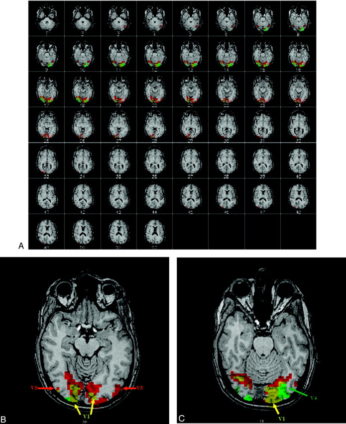 Fig 2.