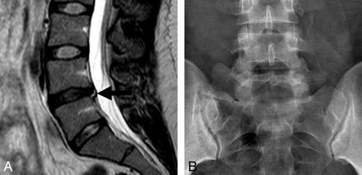 Fig 13.