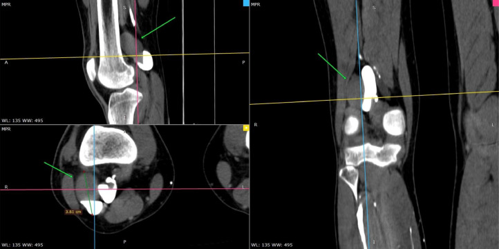 Fig. 11