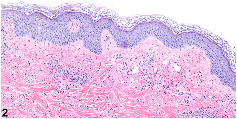 Fig 2