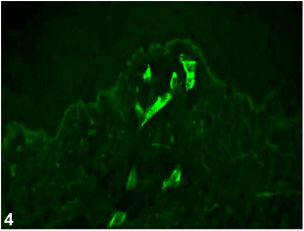 Fig 4