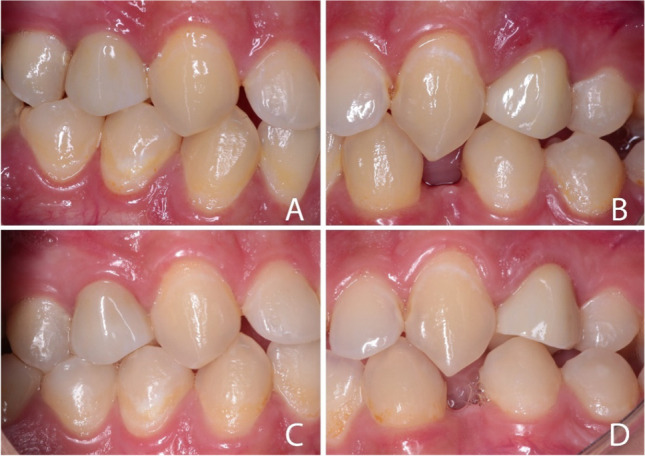 Fig. 6
