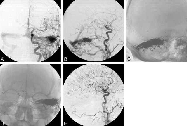 Fig 5.