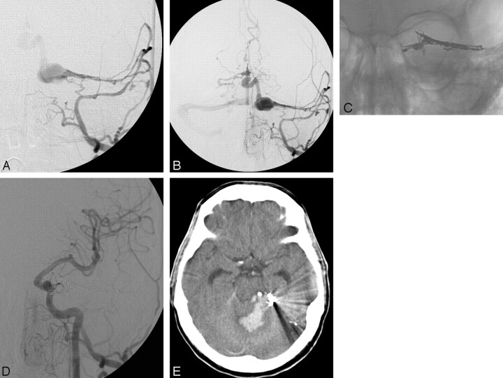 Fig 3.