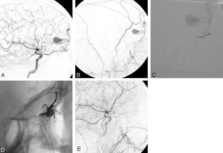 Fig 4.