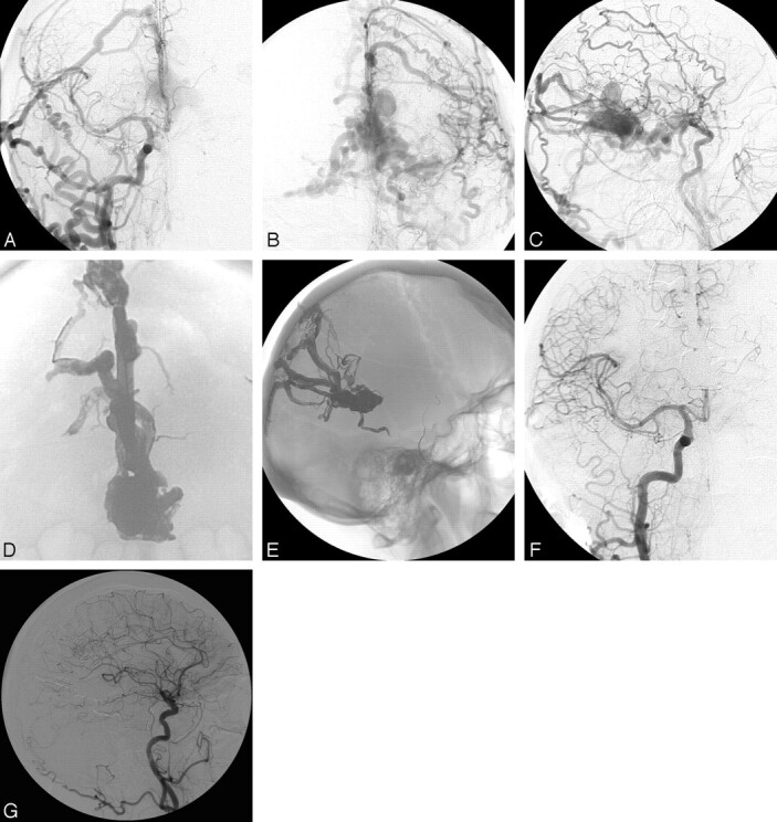 Fig 2.